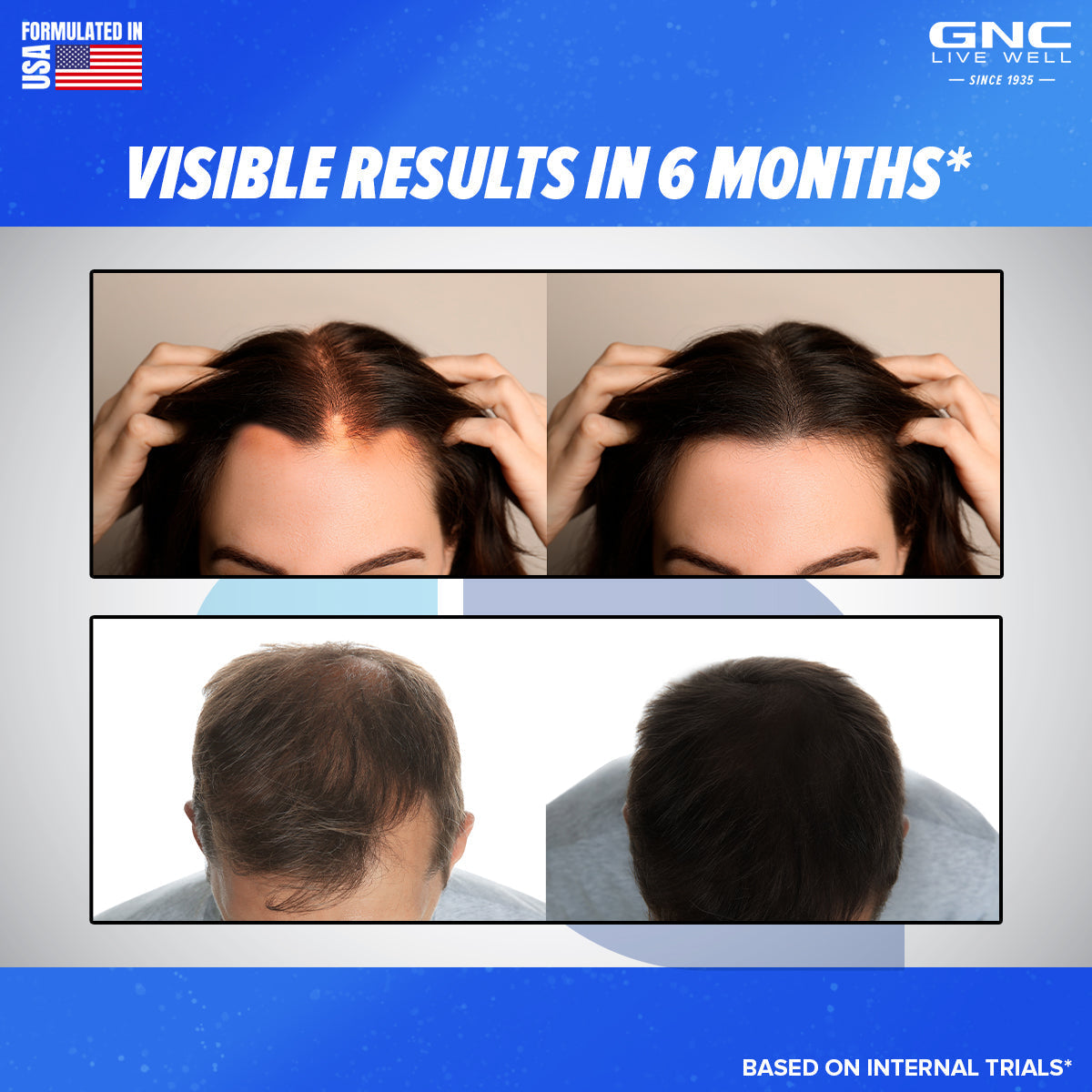 GNC Biotin 10,000mcg  Reduces Hair Fall & Promotes New Hair Growth - 30 tabs
