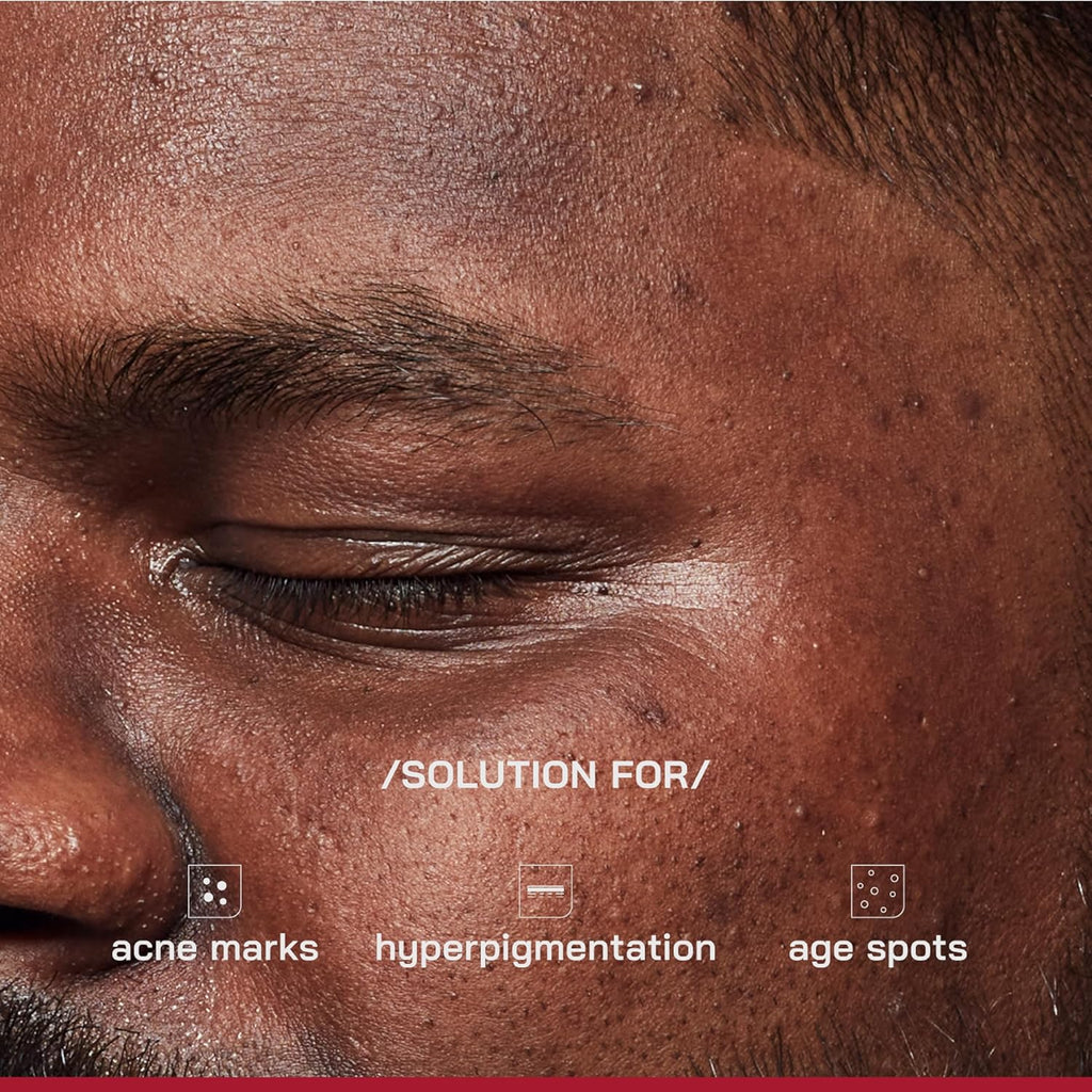 /PHD/ 2% Alpha Arbutin Depigmentation Serum | Alpha Arbutin for Pigmentation & Dark Spot | Pigmentation serum for Women & Men | Tyrobrightâ„¢, Niacinamide | Tan removal | Fragrance-Free | 10ml