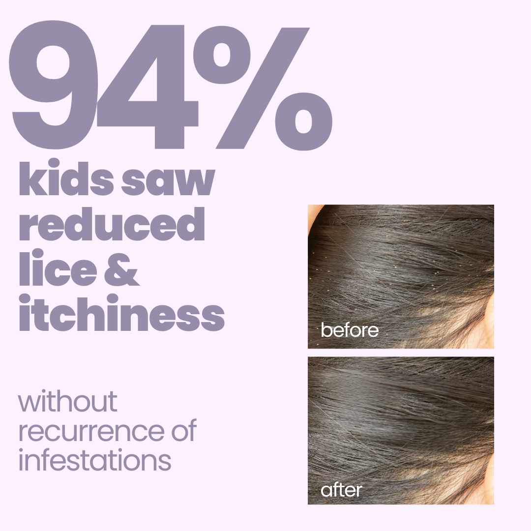 Tuco Kids Anti Lice Shampoo for Kids - 100 ml