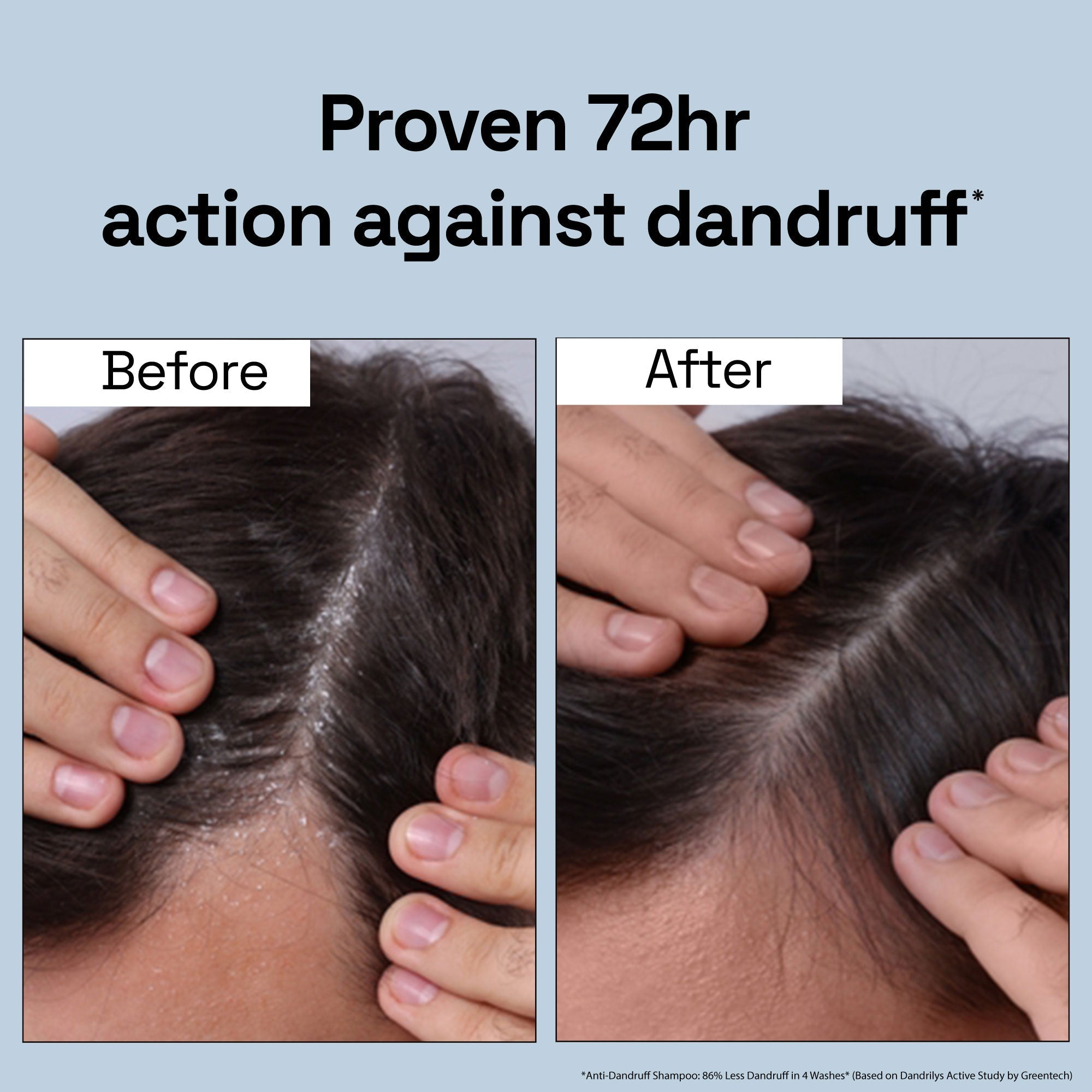 Soulflower Daily Anti Shedding Dandruff Shampoo - 100 ml