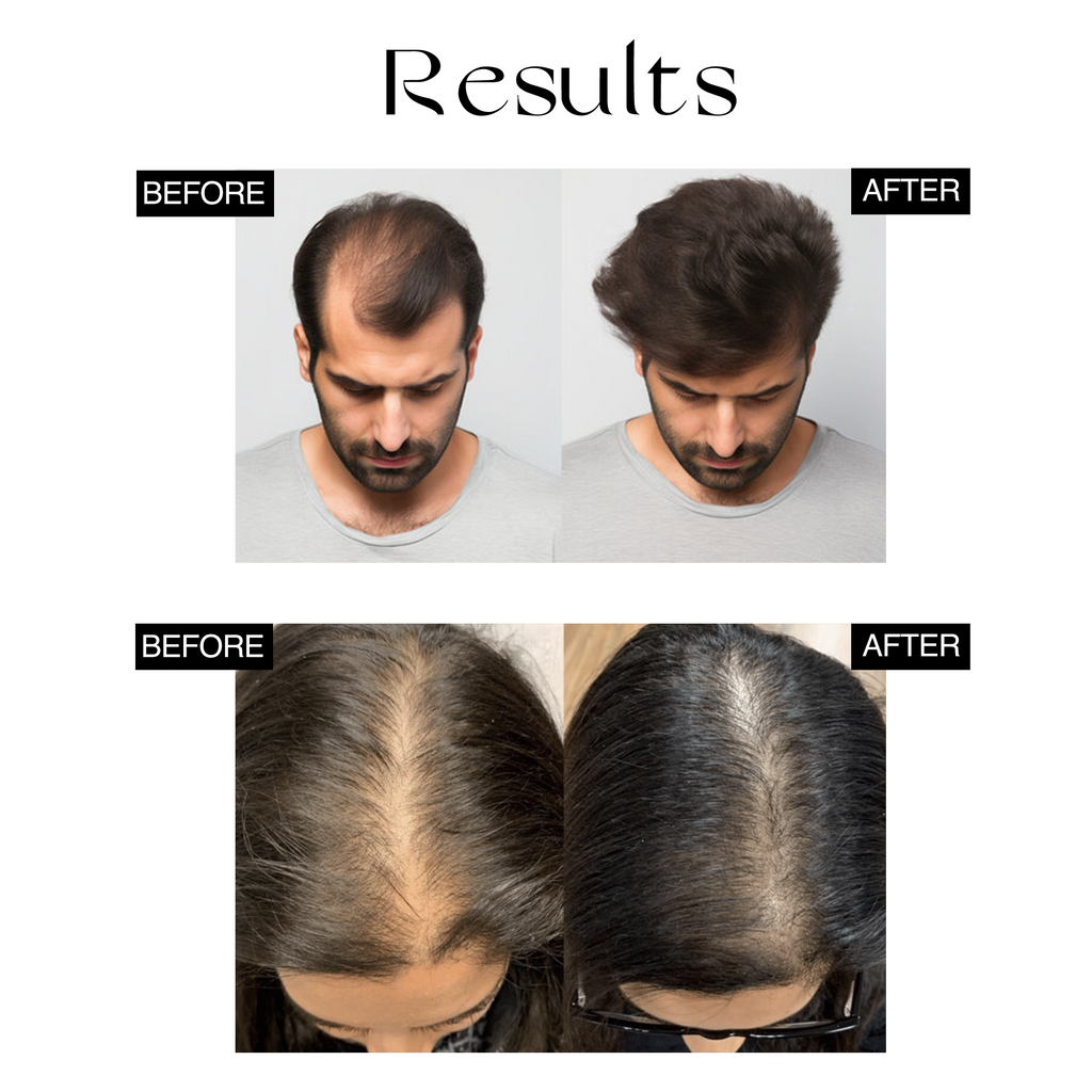 Nourish Mantra Advanced Hair growth serum - 50 ml