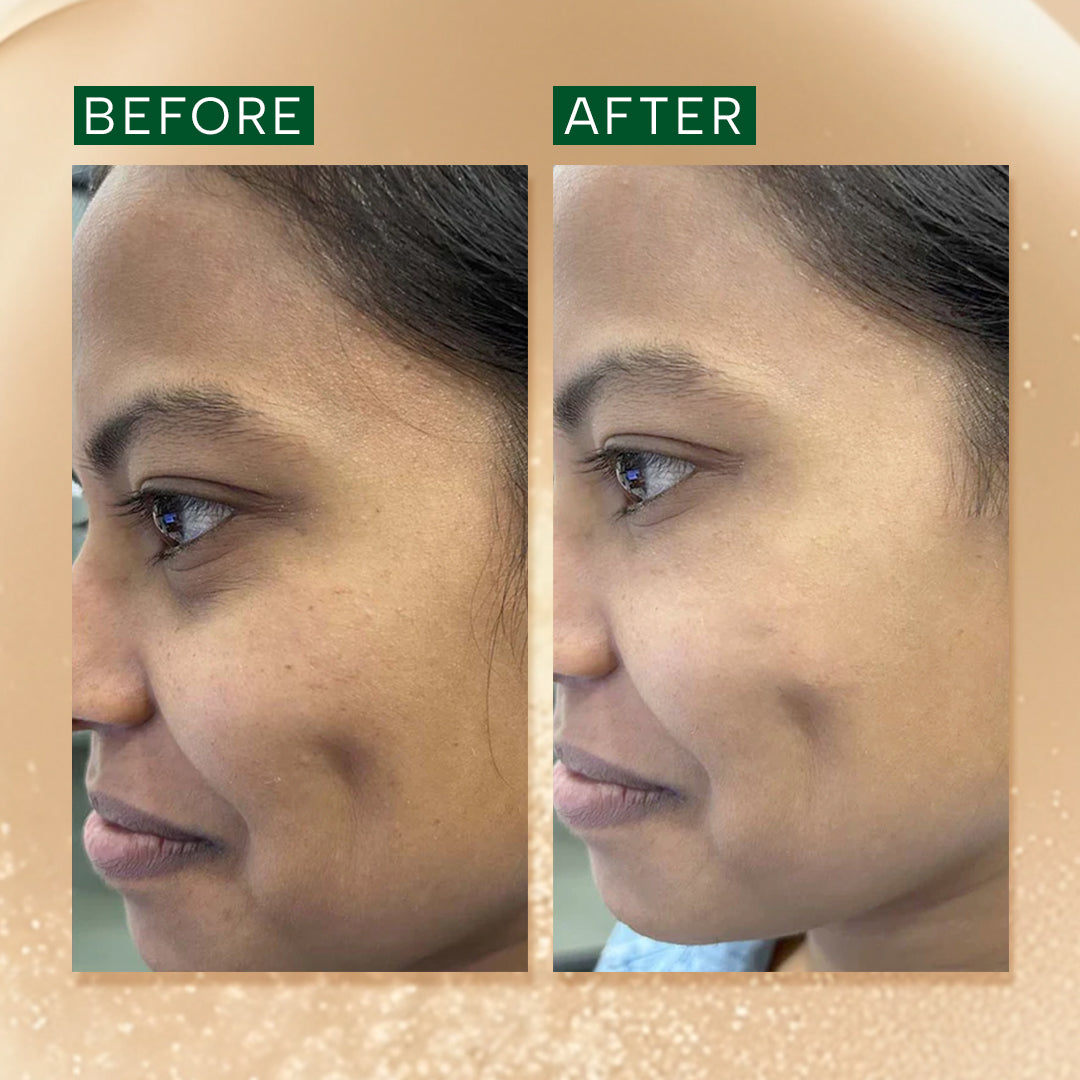 Ras Luxury Skincare Brightening & Anti Pigmentation Advanced Booster Serum - 30 ml