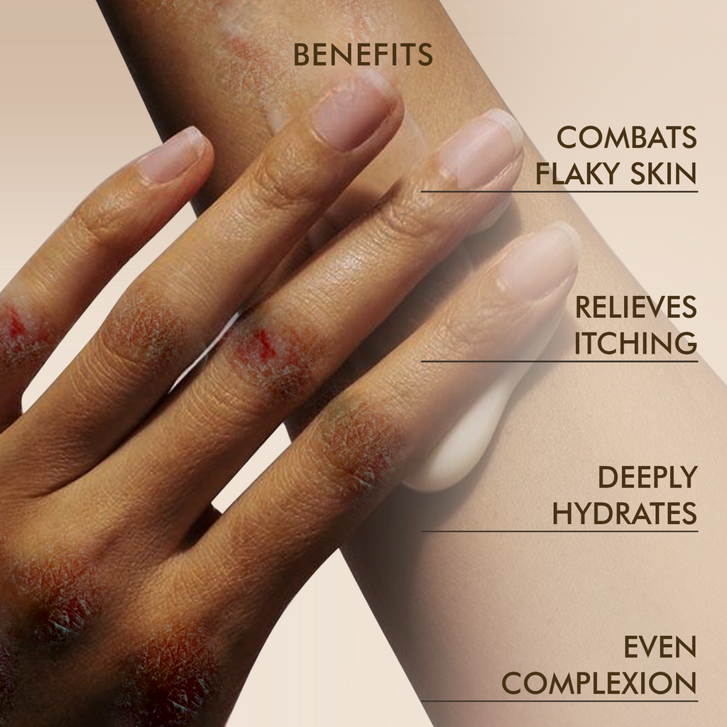 Vedicderm Skin Support Cream With 2% Bakuchi Extract - 200 Gms