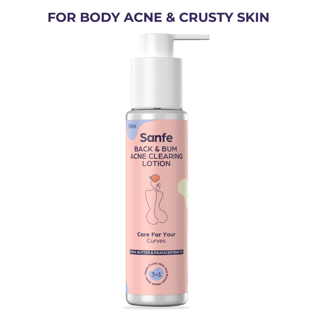 Sanfe Body Acne Clearing Lotion - 100 ml
