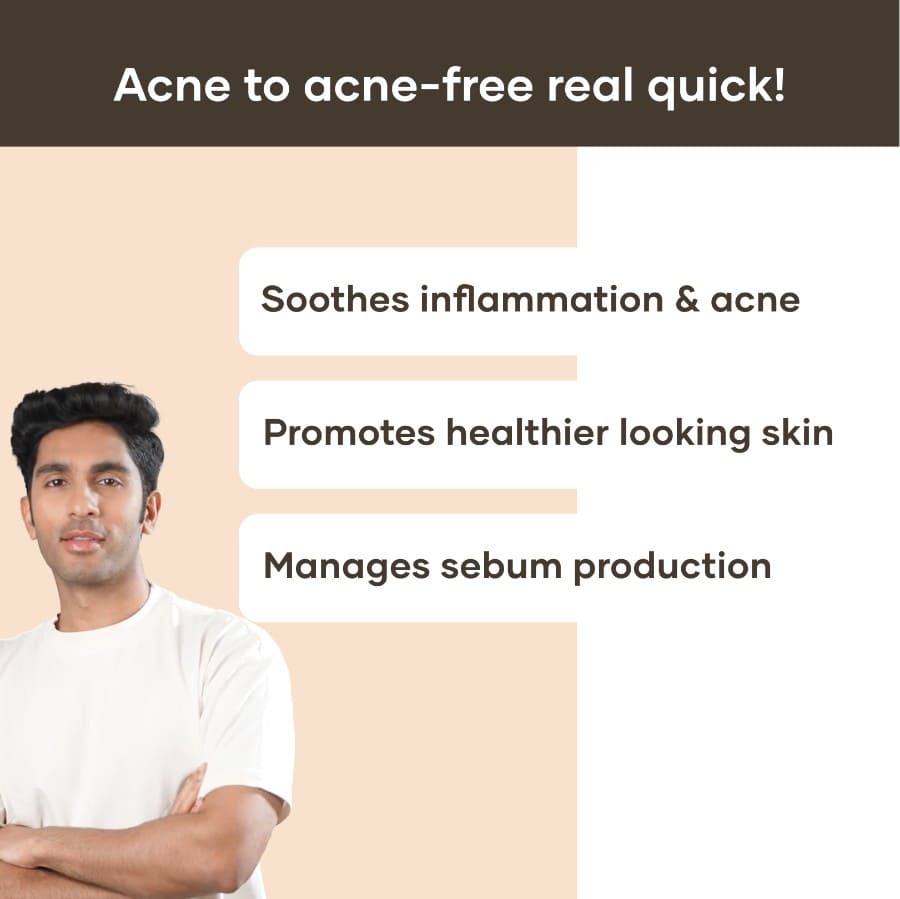 Mars by GHC Best Anti Acne Gel for Men - 30 ml