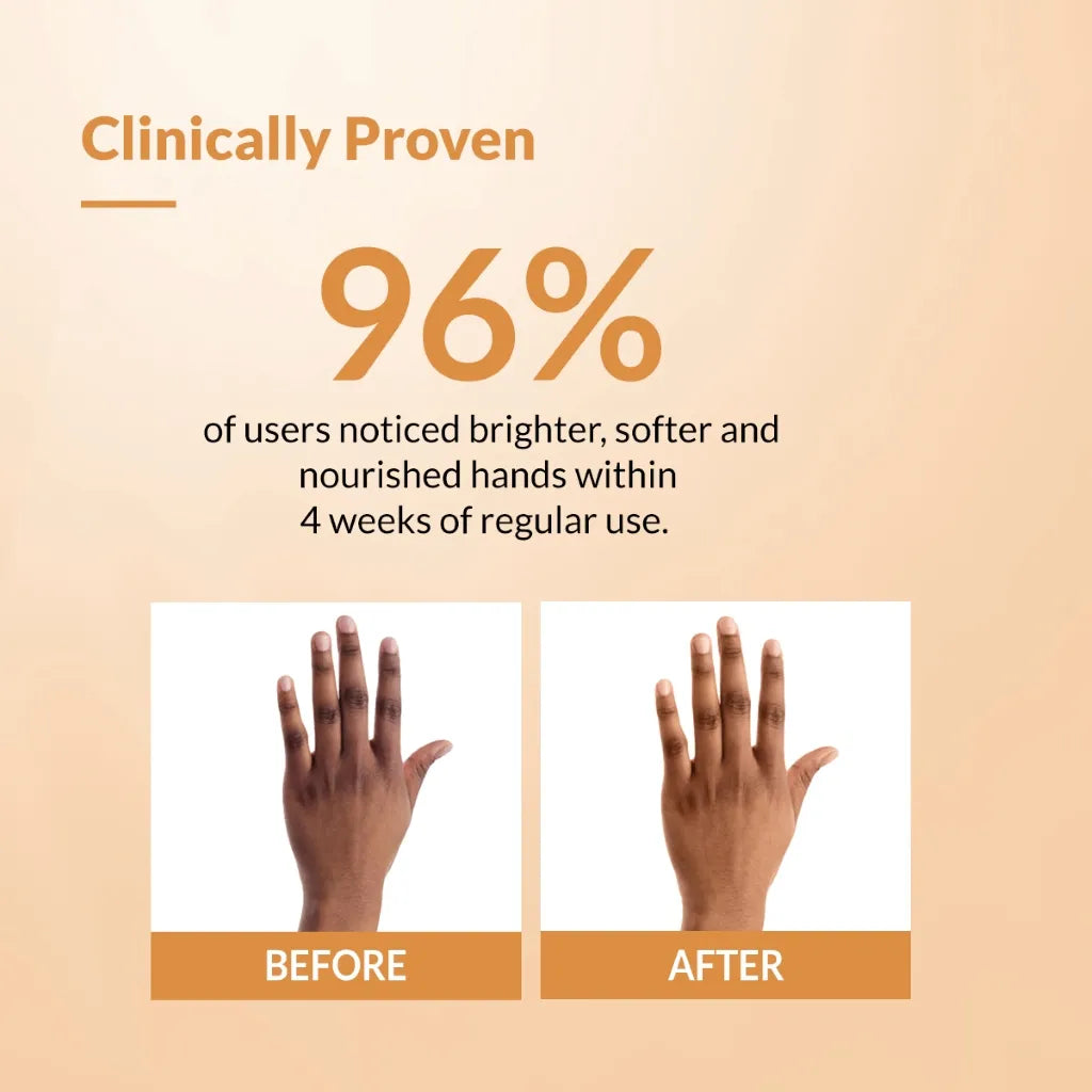 Fixderma Brightening Hand Cream - 30 gms