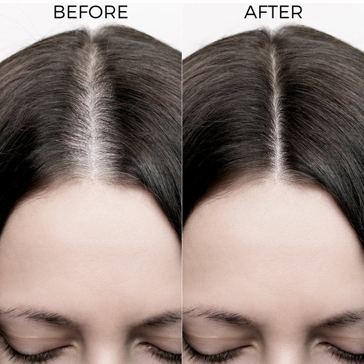 Brillare Rosemary Oil Shots For Visible Hair Growth