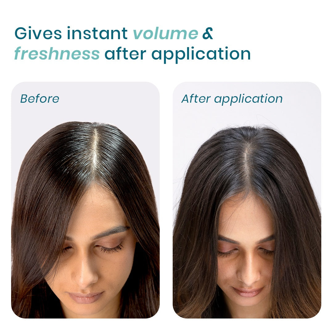 WishCare Air Powder Dry Shampoo - 10 gms