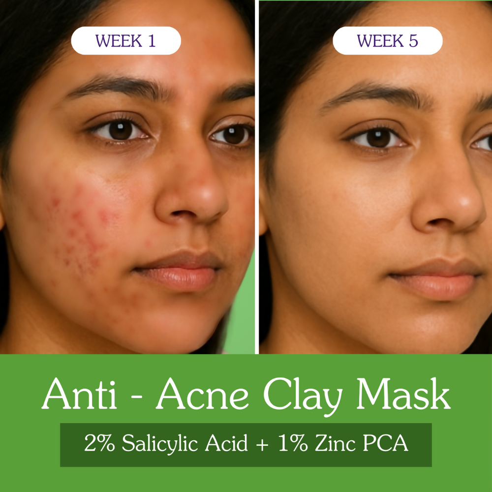Bake 2% Salicylic Acid + Zinc PCA Anti-Acne Clay Mask - Combo