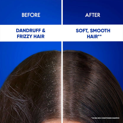 Head & Shoulders 2-in-1 Cool Menthol Anti Dandruff Shampoo + Conditioner