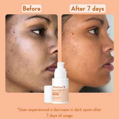 Wishcare Super Bright C16 Vitamin C Face Serum