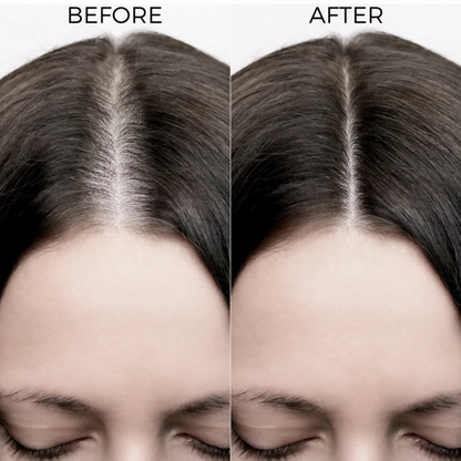 Brillare Rosemary Oil Shots For Visible Hair Growth
