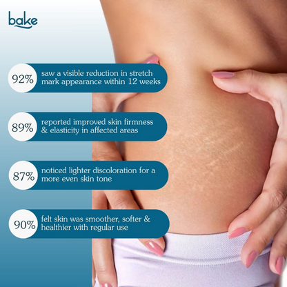 Bake StriErase™ Stretch Marks Removal Roll-On Serum