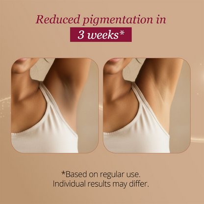 Carmesi Restore Underarm Spray With 5% Glycolic Acid
