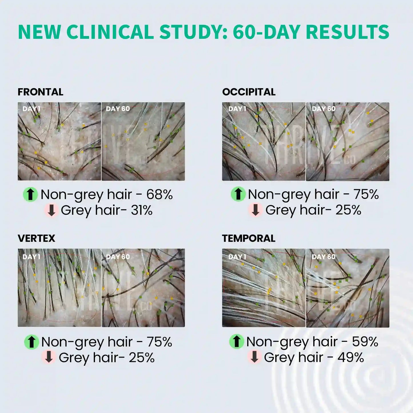 Thriveco Anti-Grey Hair Prime Serum - 50 ml