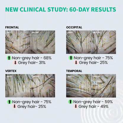 Thriveco Anti-Grey Hair Prime Serum - 50 ml