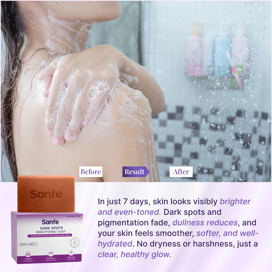 Sanfe Kojic Acid Soap for Dark Spots & Pigmentation - 75 gms