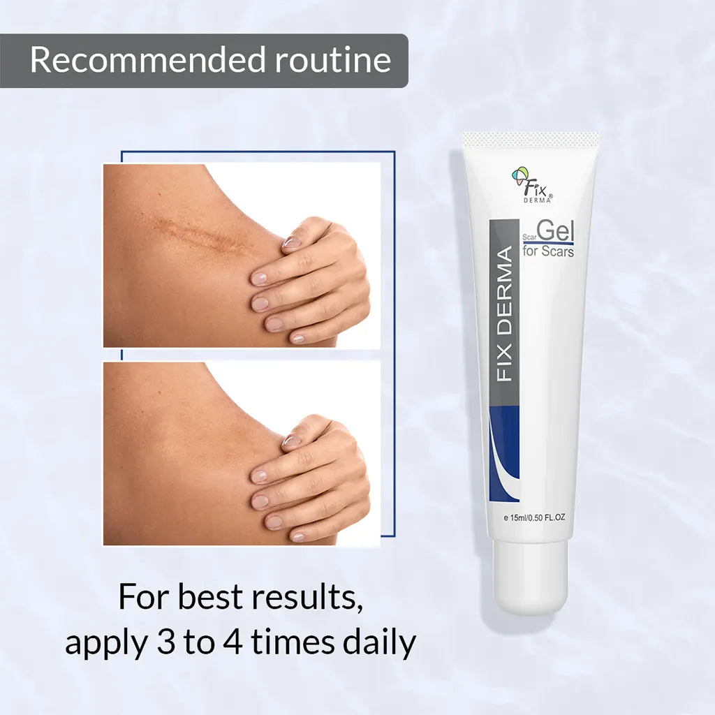 Fixderma Scar Gel for Scars - 15 ml