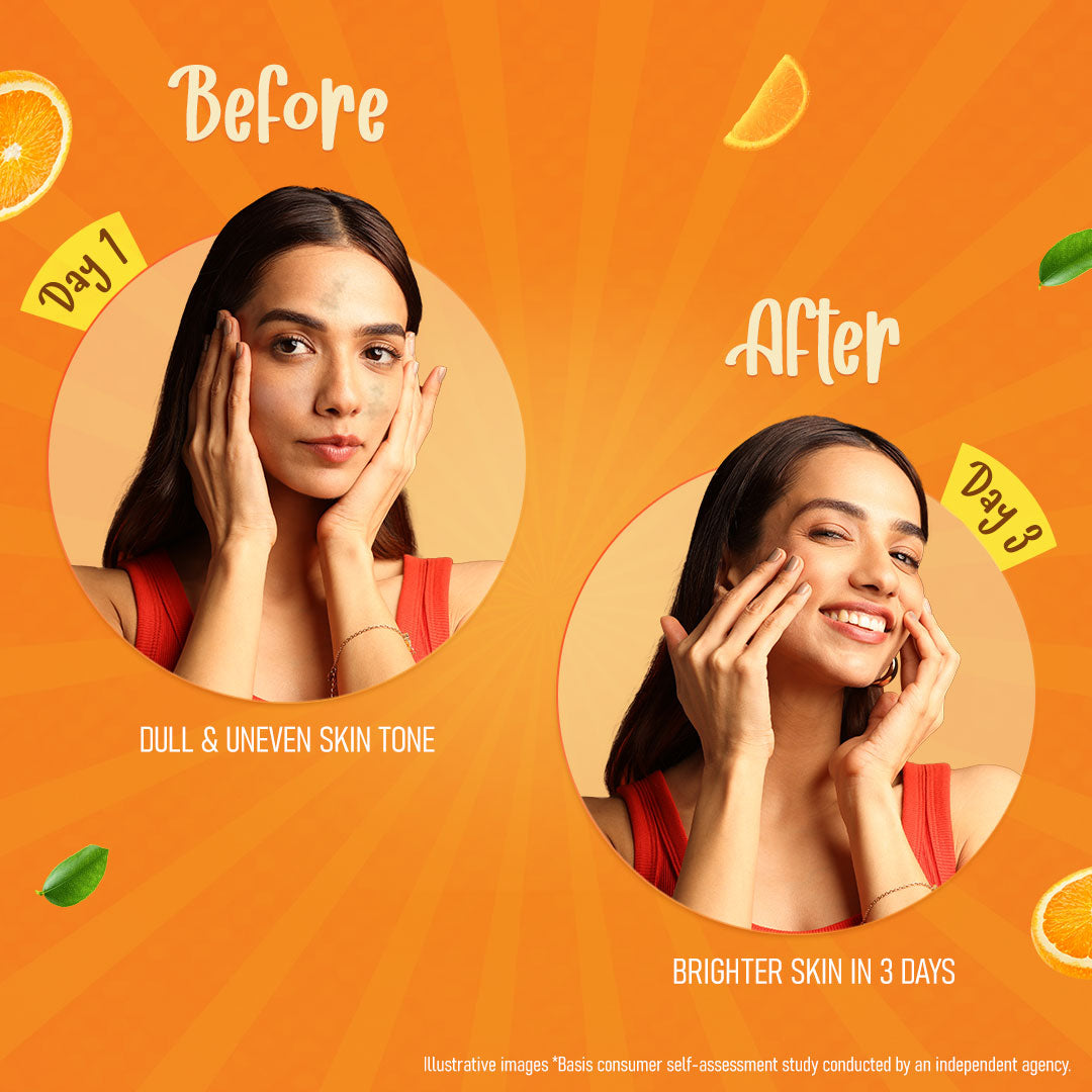 Himalaya Brightening Vitamin C Orange Face Serum Cream - 50 gms
