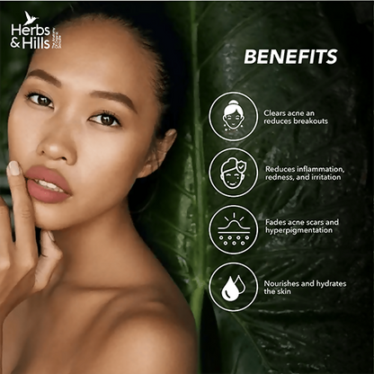 Herbs & Hills Anti Acne Face Pack