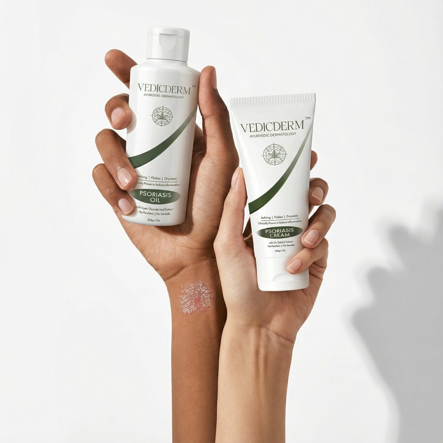 VedicDerm Sensitive Skin Bundle for Psoriasis, Eczema, Atopic Dermatitis