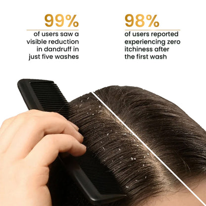 The Skin Story Anti Dandruff Deep Ceansing Shampoo Calms & Soothes Scalp With Saniscalp & Argan Oil