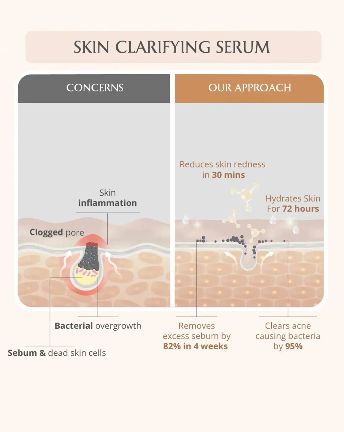 AreoVeda Acne Care Ritual
