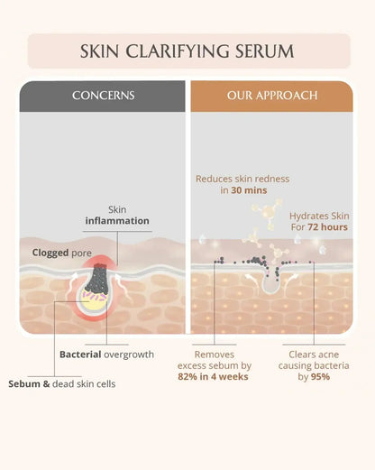 AreoVeda Acne Care Ritual
