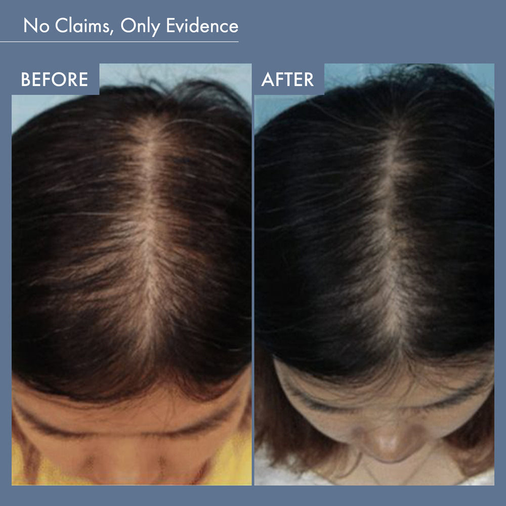 ThriveCo Rosemary Hair Growth Trio Serum, Shampoo & Conditioner