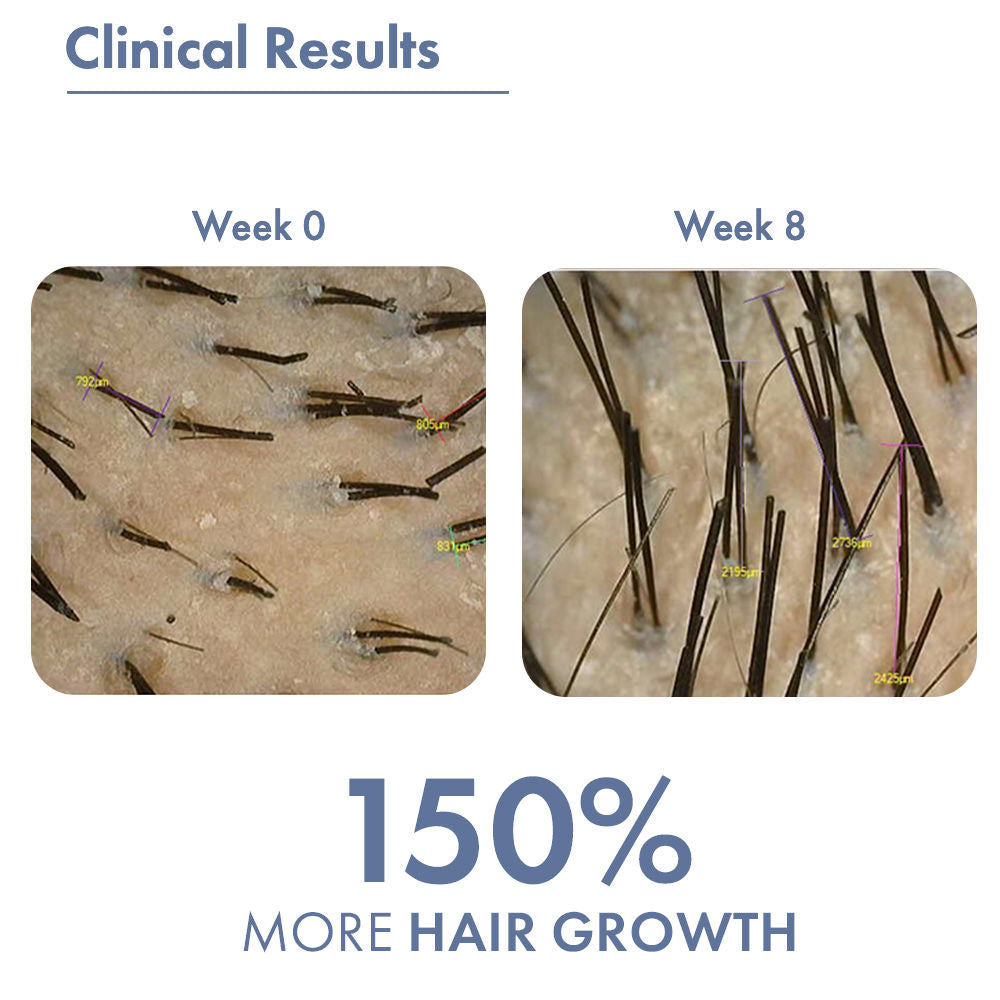 ThriveCo Rosemary Hair Growth Trio Serum, Shampoo & Conditioner