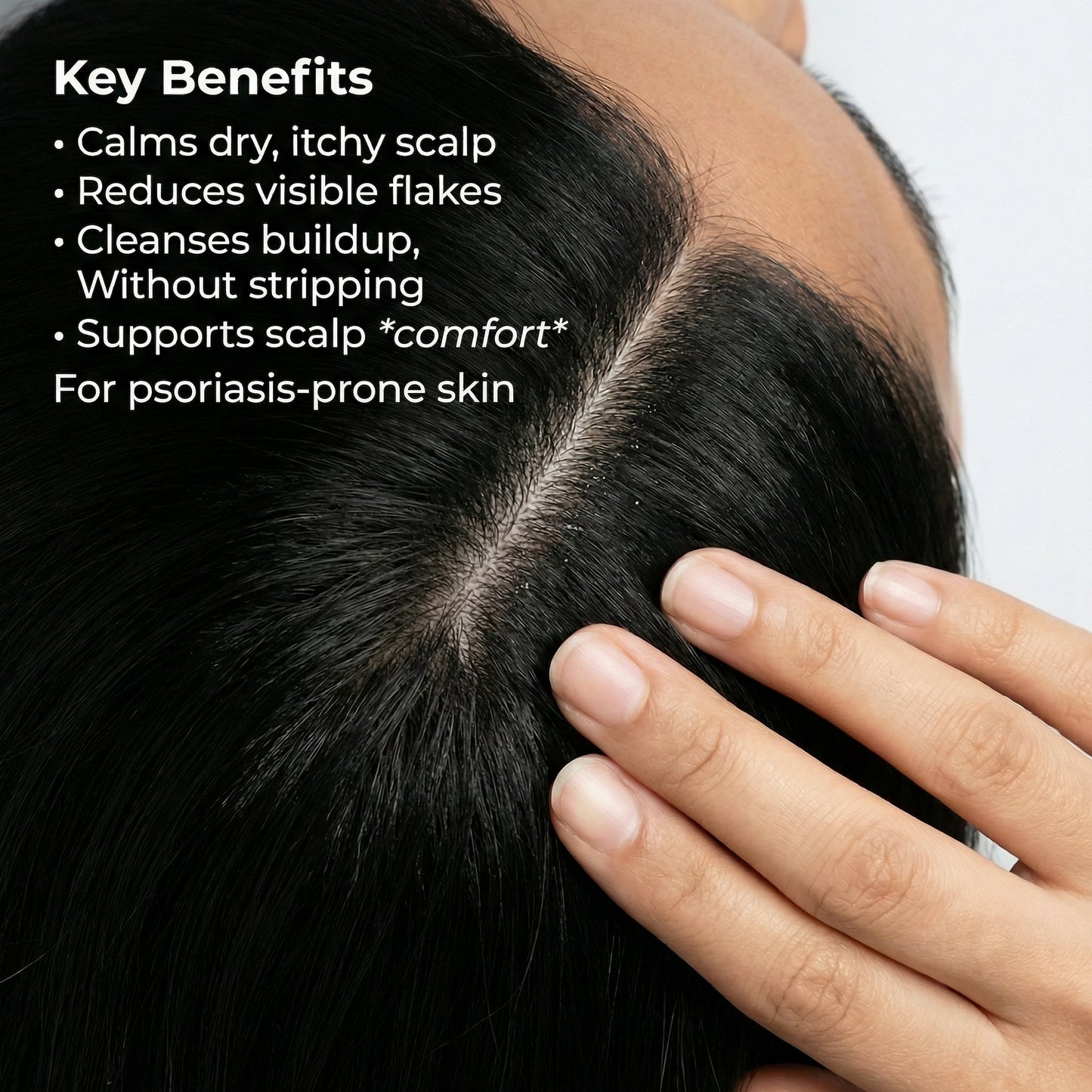 VedicDerm Sensitive Scalp Bundle for Psoriasis, Dandruff, & Itchy Scalp