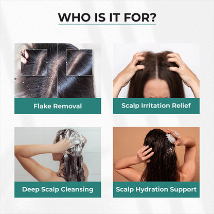Dr.Sakhiya Anti-Dandruff Shampoo, Itchy Scalp Relief For Men & Women