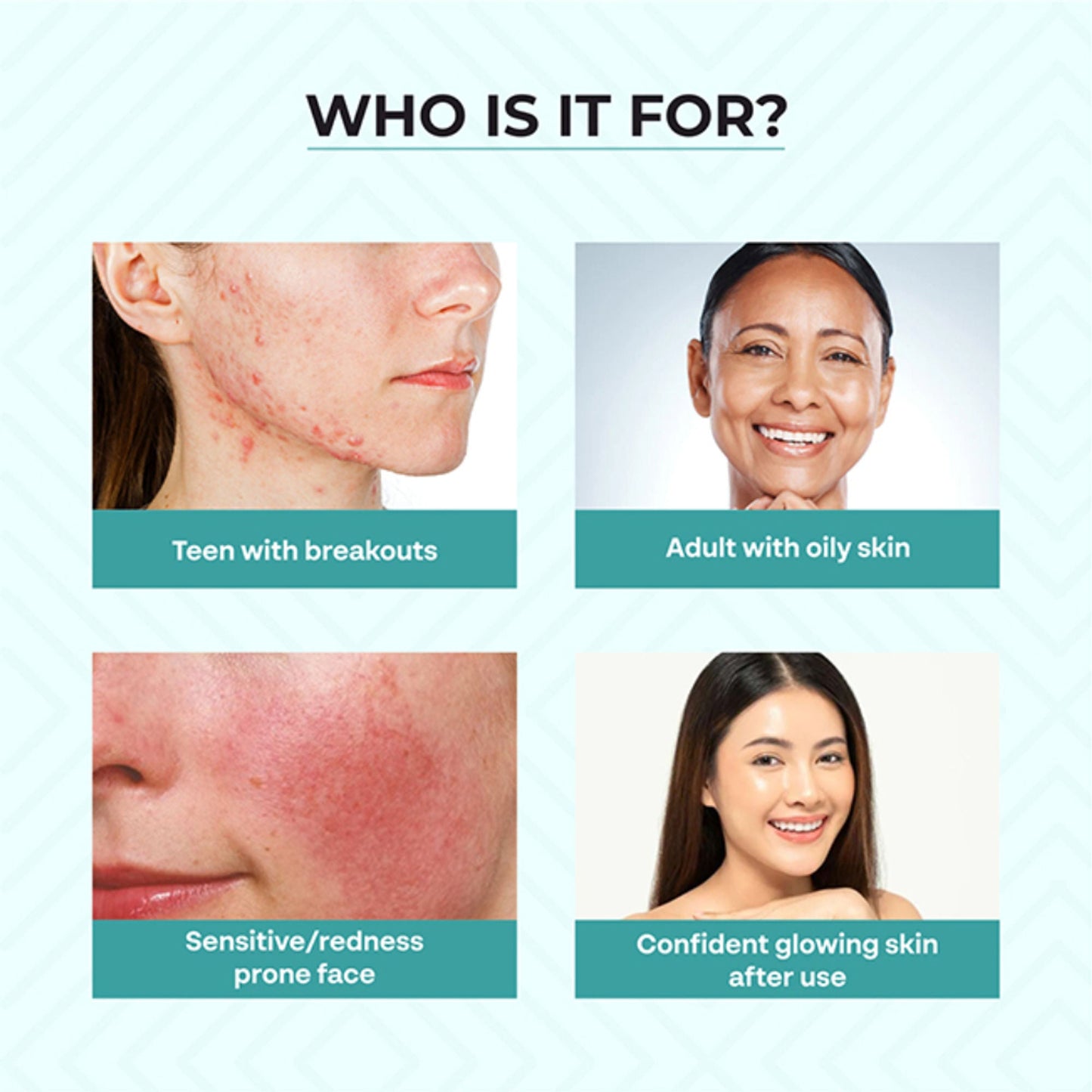 Dr.Sakhiya Acne & Pimple Care Kit