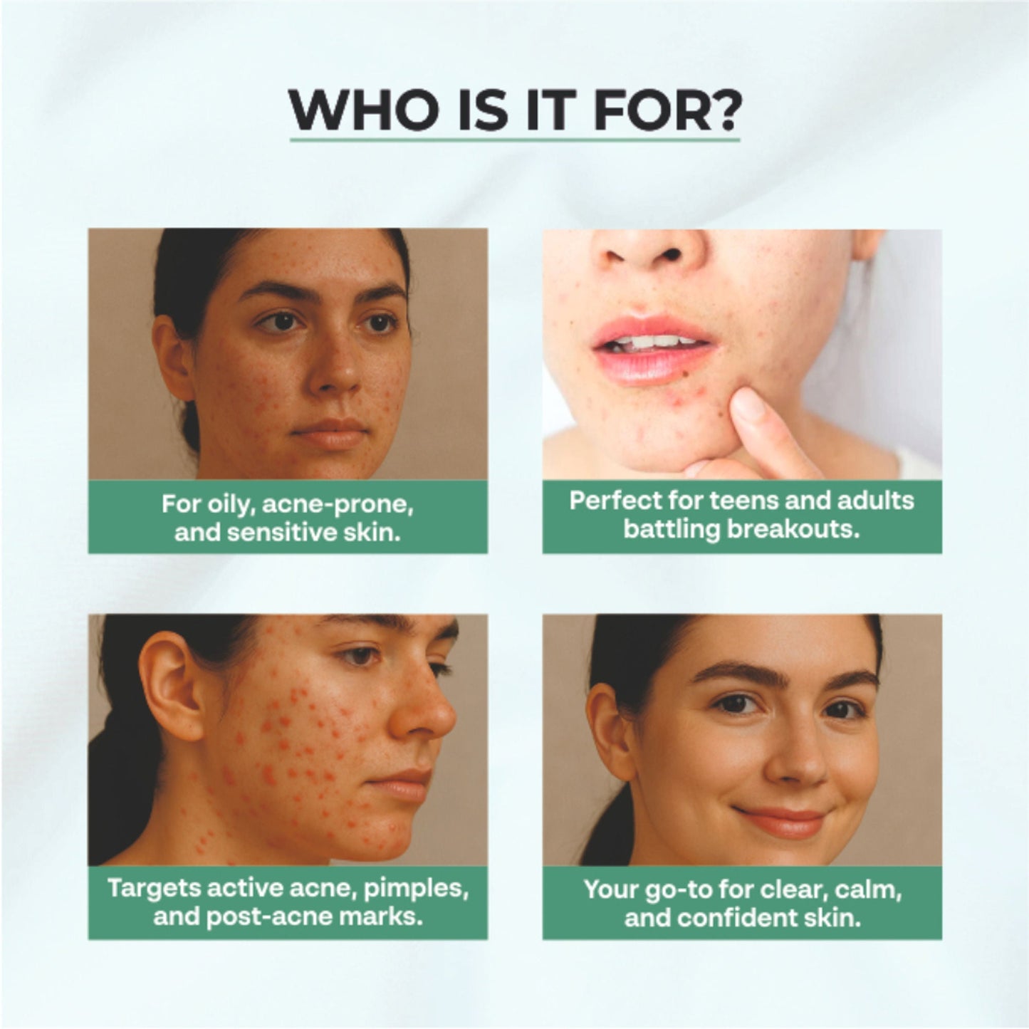 Dr.Sakhiya Acne & Pimple Moisturizer