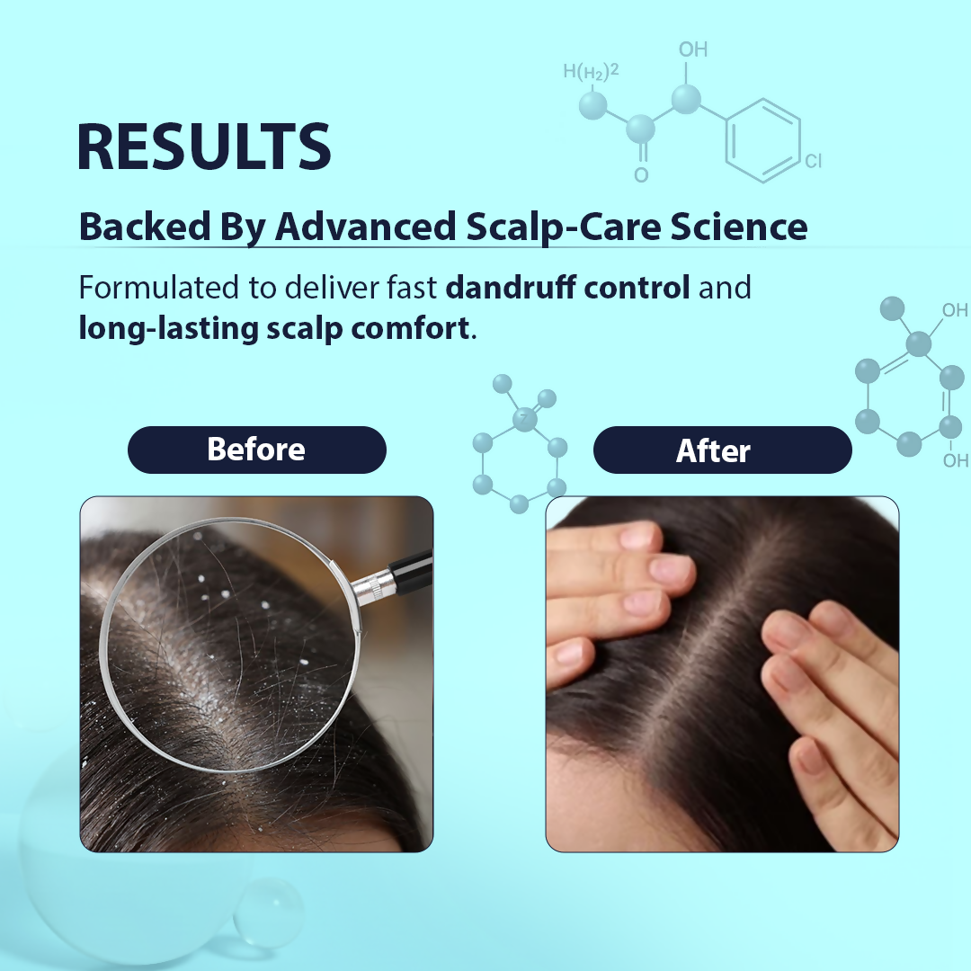 Dermistry Anti-Dandruff Control Shampoo