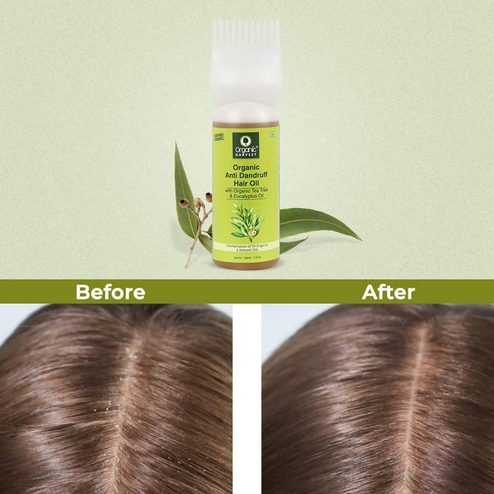 Organic Harvest Organic Anti Dandruff Hair Oil - 150 ml