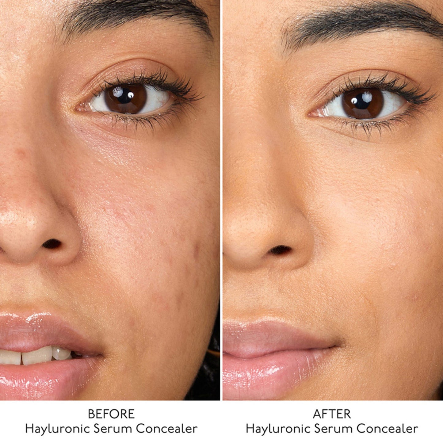 By Terry Hyaluronic Serum Concealer - 3. Apricot Nude