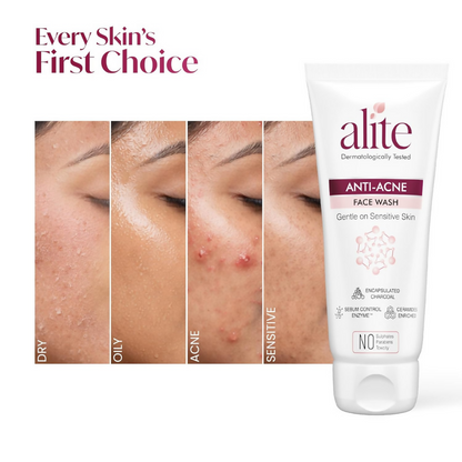 Alite Anti-Acne 5-in-1 Face Wash - Encapsulated Charcoal, Sebum Control Enzyme & Ceramides