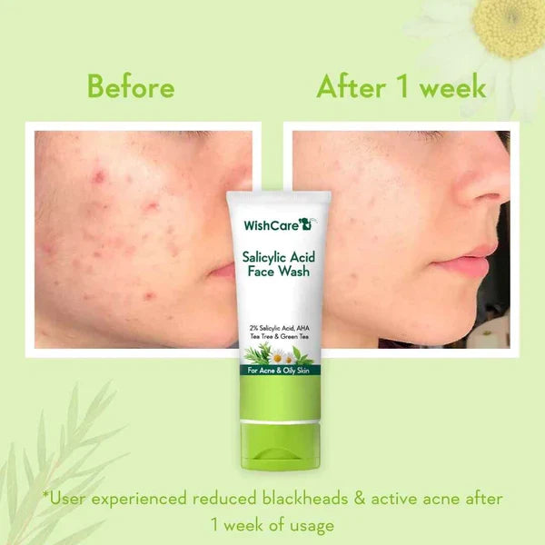 2% Salicylic Acid Face Wash - 100ml