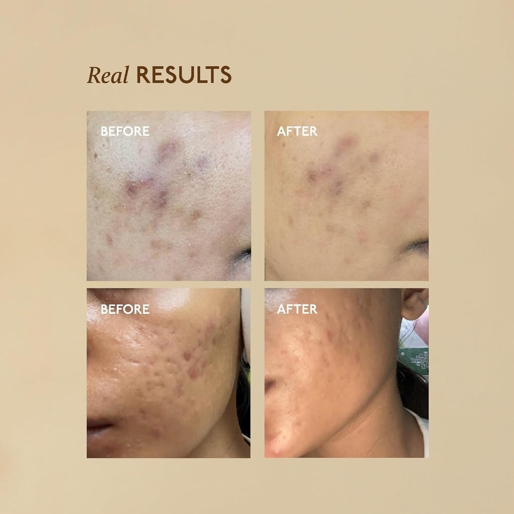 Asaya Advanced Spot Pigmentation Face Serum - 30 ml
