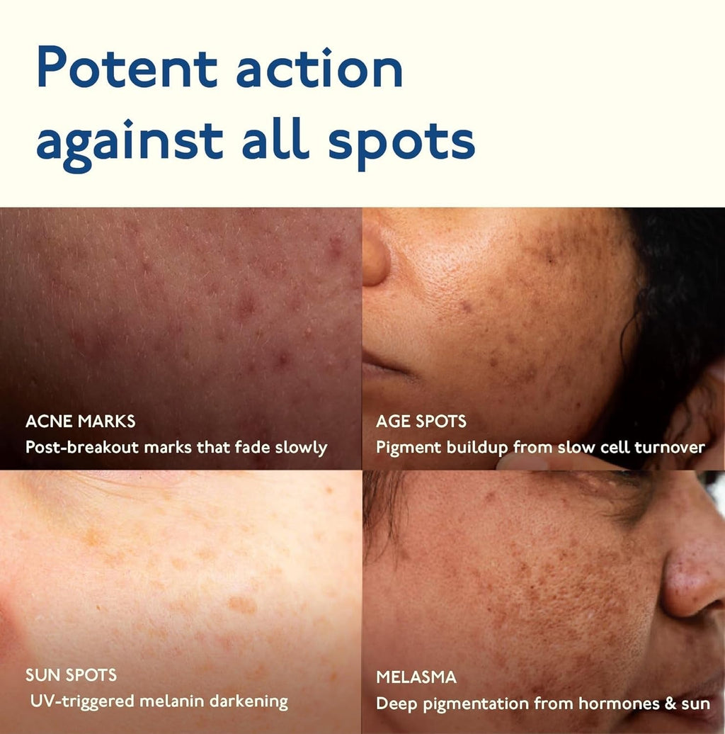 Asaya Advanced Dark Spot Targeting Face Gel - 15 Gms