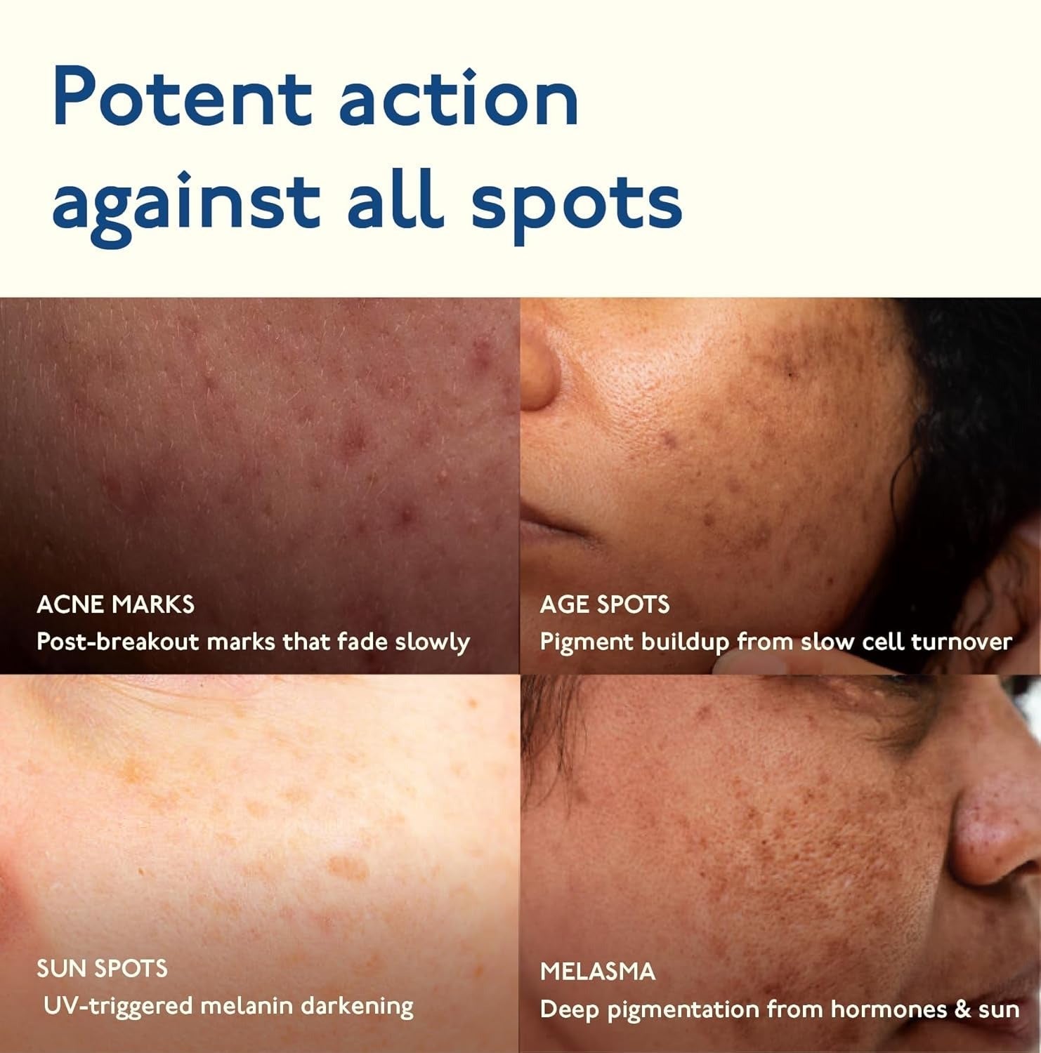 Asaya Advanced Dark Spot Targeting Face Gel - 15 Gms