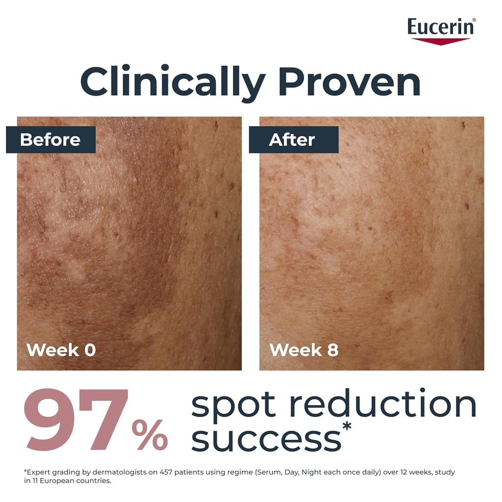 Eucerin Anti Pigment Face Night Cream with Thiamidol, Reduces Dark Spots and Regenerates Skin - 50 ml