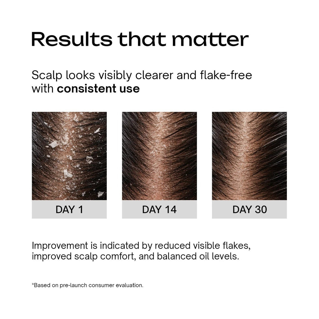 Underated Hair SLS Free Anti Dandruff Shampoo - 200 Gms