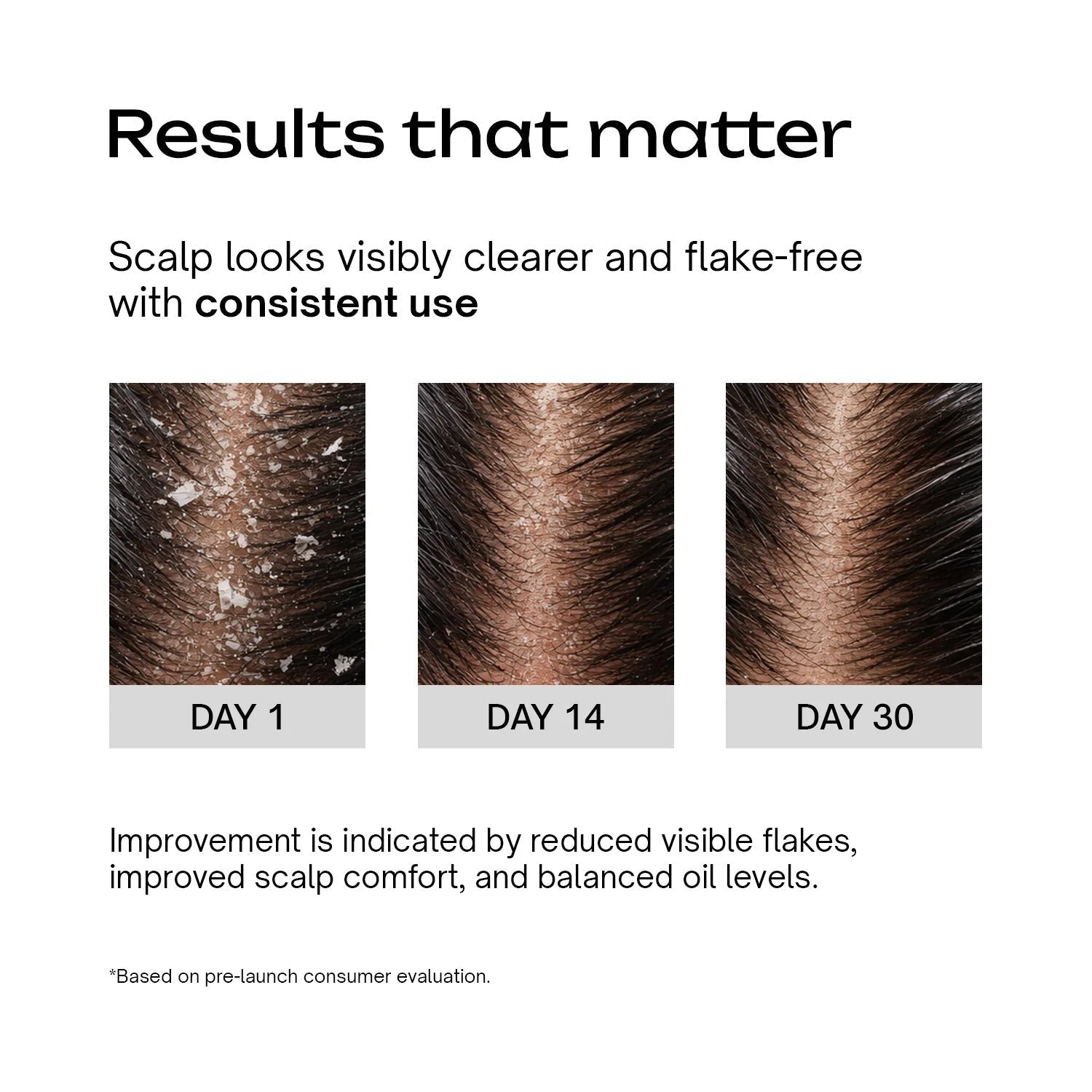 Underated Hair SLS Free Anti Dandruff Shampoo - 200 Gms