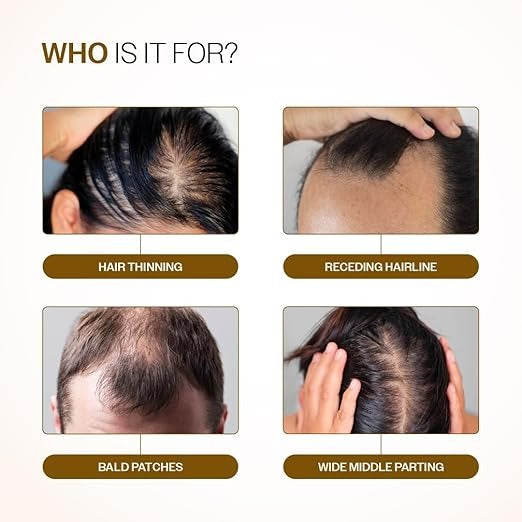 Bare Anatomy Advanced Hair Growth Serum Roll-On - 25 ml