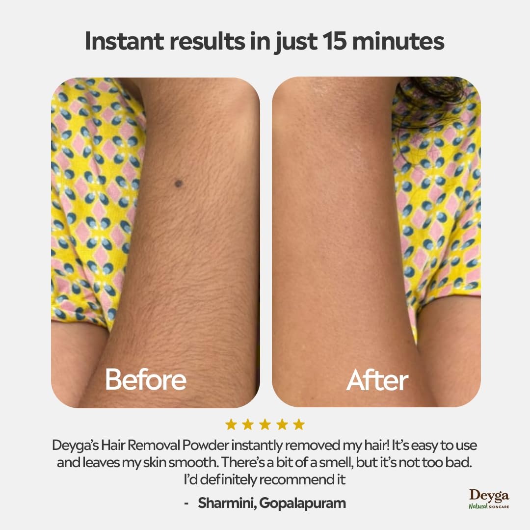 Deyga Herbal Hair Removal Powder - 100 gms