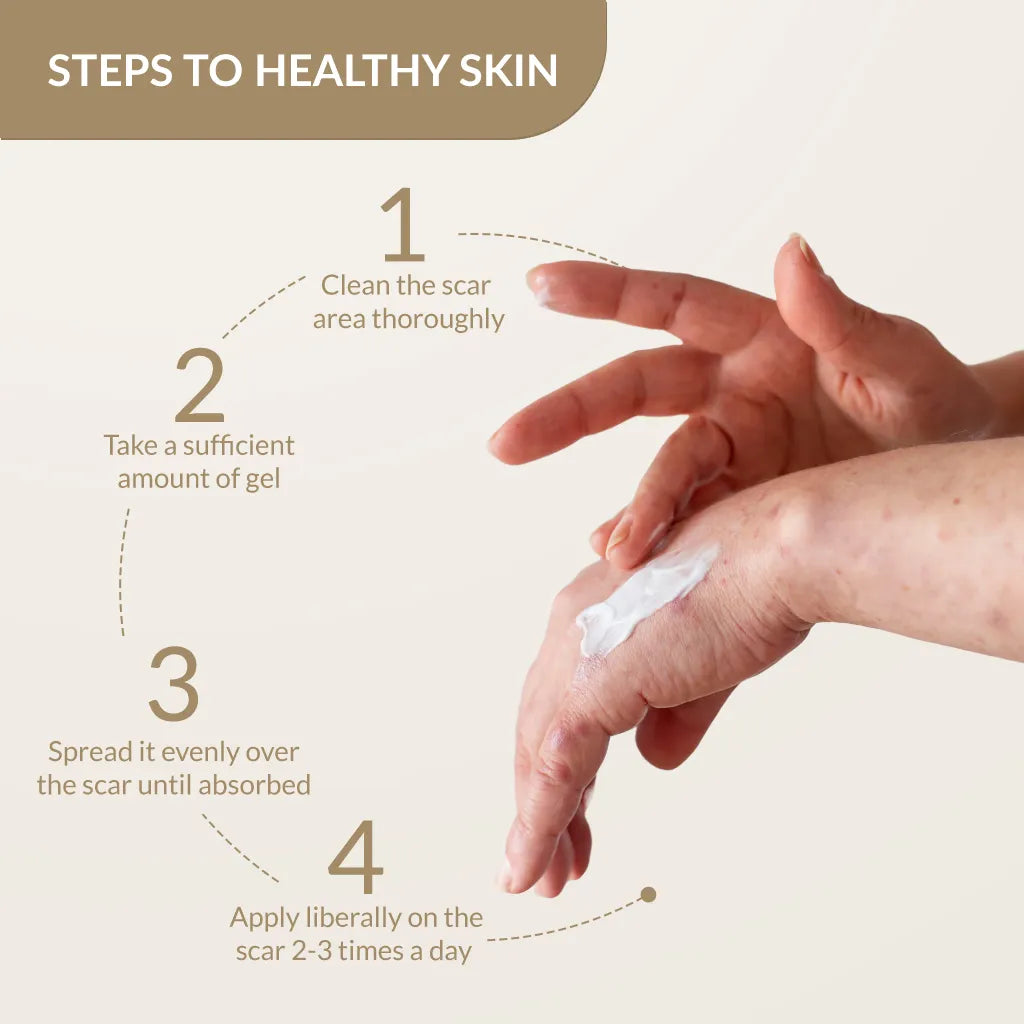 Fixderma Kelocepa Silicone Gel - 25 ml