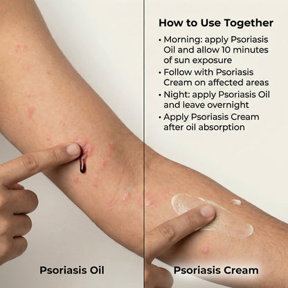 VedicDerm Sensitive Skin Bundle for Psoriasis, Eczema, Atopic Dermatitis
