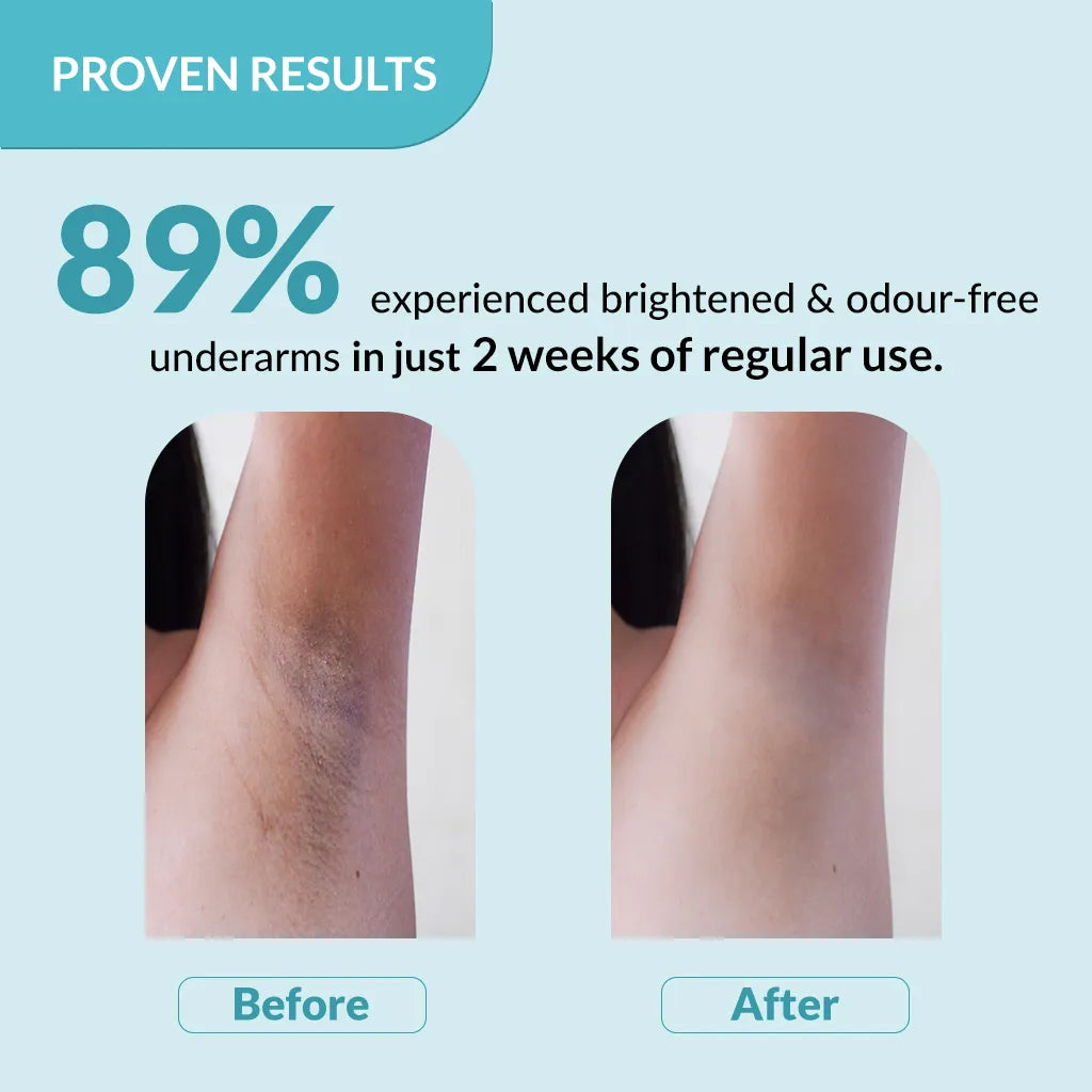 Fixderma Nigrifix Underarm Lightening Ocean Roll On - 60 ml